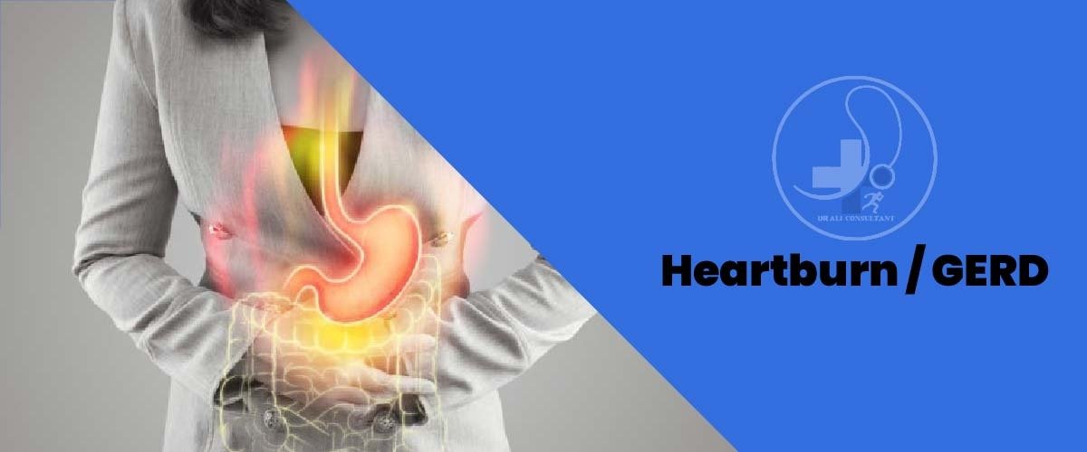 Read more about the article Heartburn / GERD