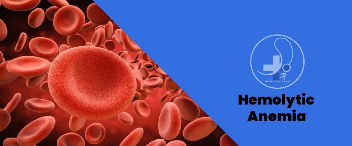 Read more about the article Hemolytic Anemia