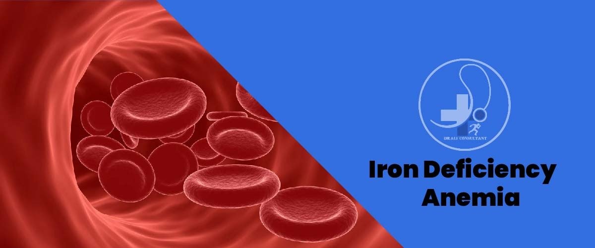 Read more about the article Iron Deficiency Anemia