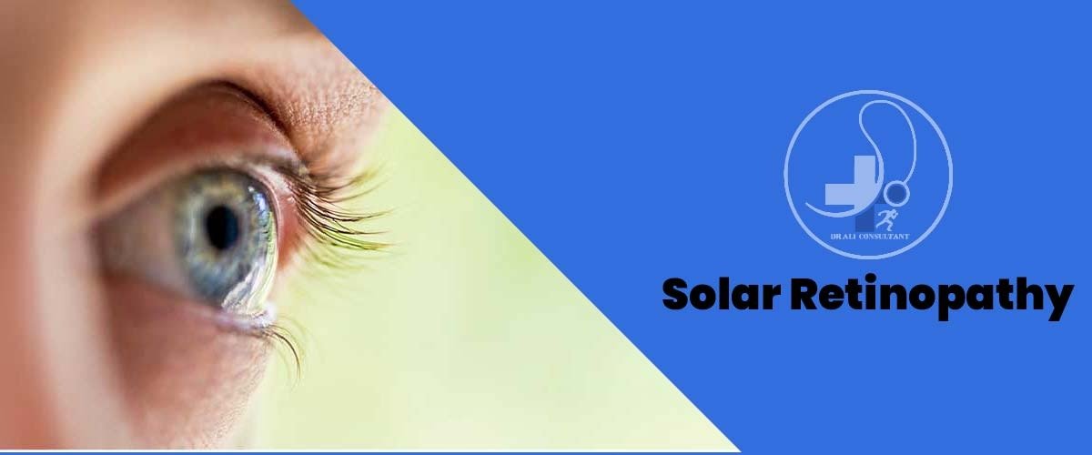 Read more about the article Solar Retinopathy