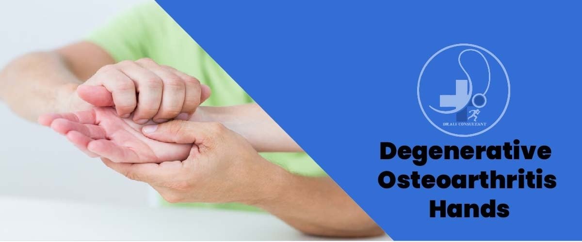 You are currently viewing Degenerative Osteoarthritis Hands