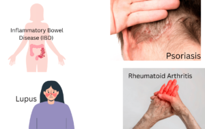 Inflammatory Bowel Disease (IBD), Rheumatoid Arthritis, chronic autoimmune disorders