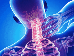 chronic neck pain