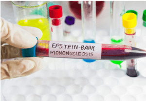 Read more about the article Epstein-Barr Virus (EBV)