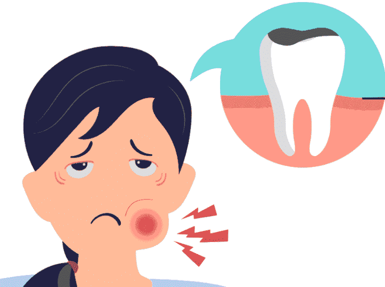 Toothache: Causes, Symptoms, and When to Seek Dental Care