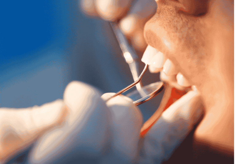 Toothache: Causes, Symptoms, and When to Seek Dental Care