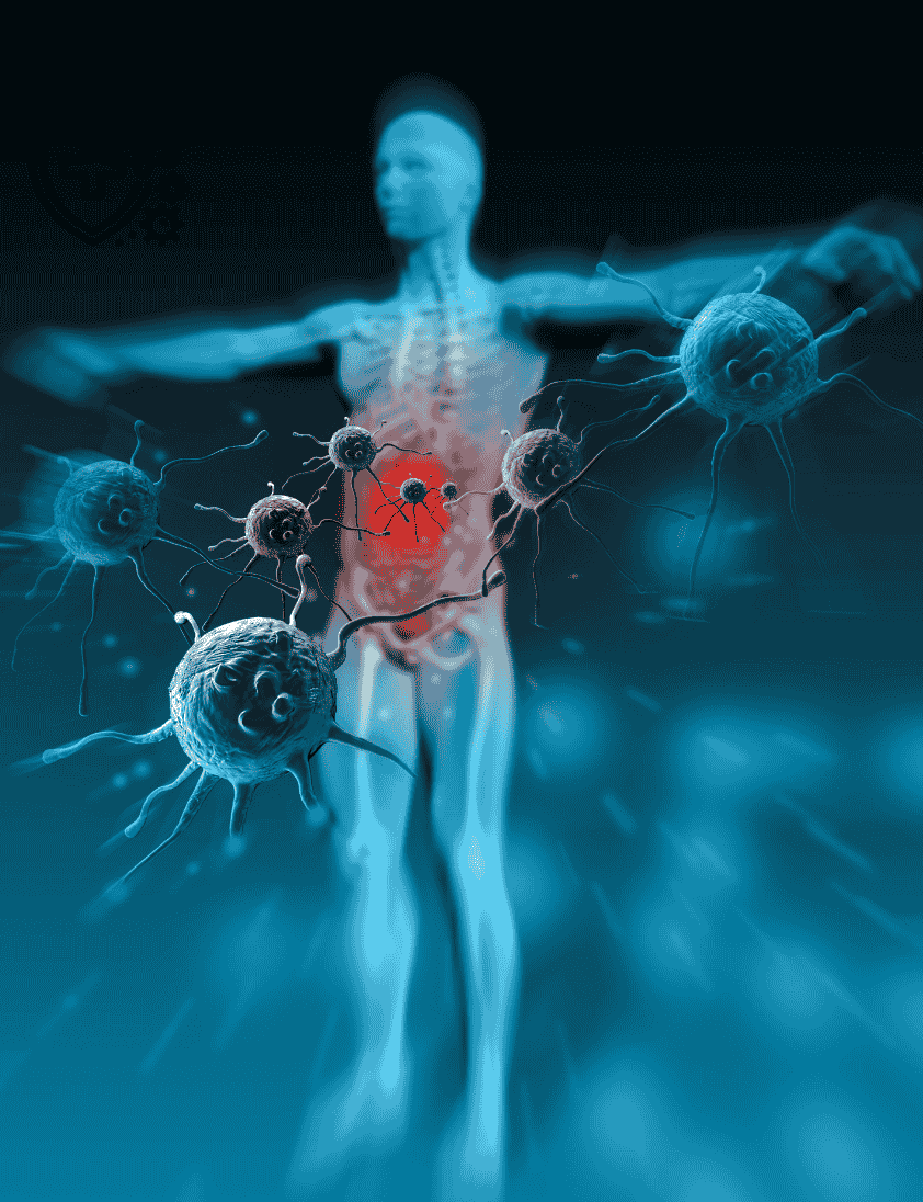 Read more about the article Chronic Radiation Proctitis: Causes, Symptoms, Diagnosis, and Effective Treatments