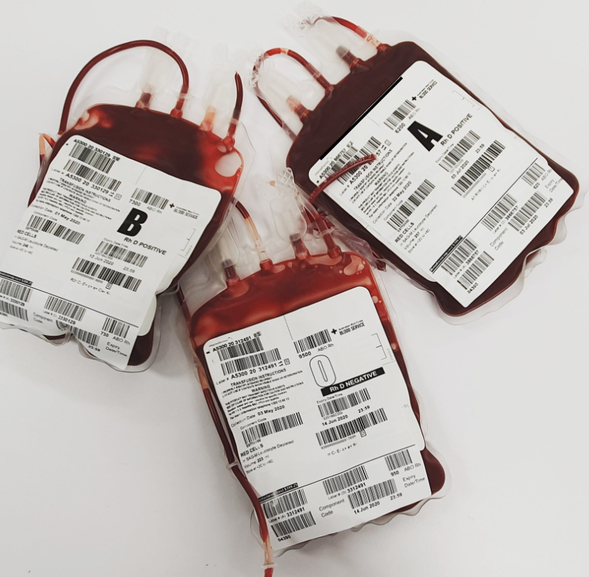 Read more about the article Chronic Blood Clots: Causes, Symptoms, and Effective Treatment Strategies