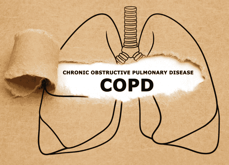 Read more about the article Chronic Obstructive Pulmonary Disease (COPD): Management & Breakthrough Therapies