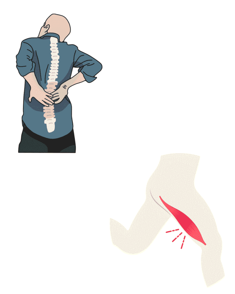 Symptoms of Chronic Tightness in the Hamstrings